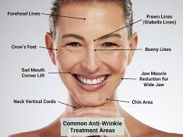 Anti-wrinkle botulinum toxin injection Singapore